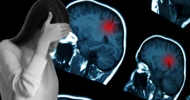 Tıp Dünyasında Skandal İhmal: Migren Denilerek Eve Gönderilen Genç Kızın Beyninden Evre 4 Tümör Çıktı!